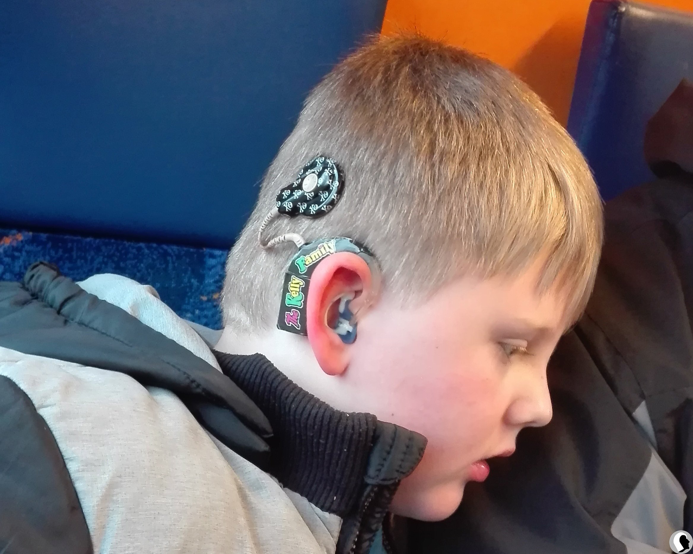 CI Kopf 2018 männlich Kind